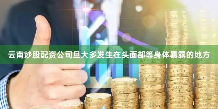云南炒股配资公司旦大多发生在头面部等身体暴露的地方